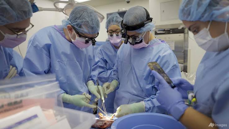 American surgeons have successfully conducted a groundbreaking second heart transplant from a pig to a human recipient