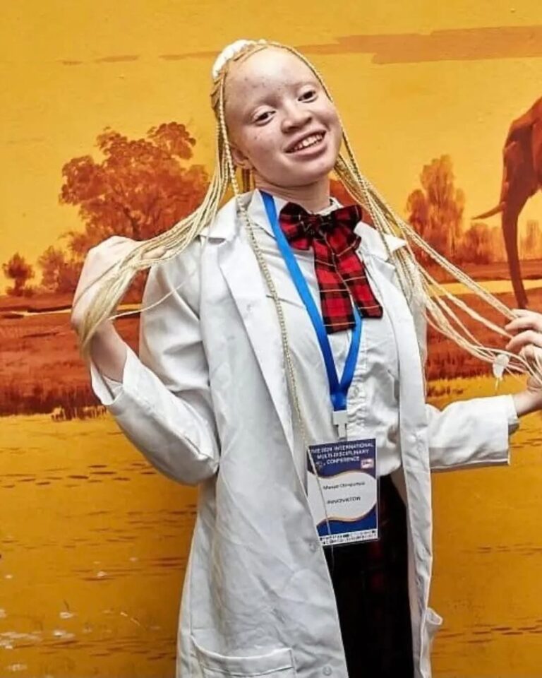 15-Year-Old Zambian Innovator Mwape Chimpampa Develops Affordable Natural Sunscreen for People with Albinism