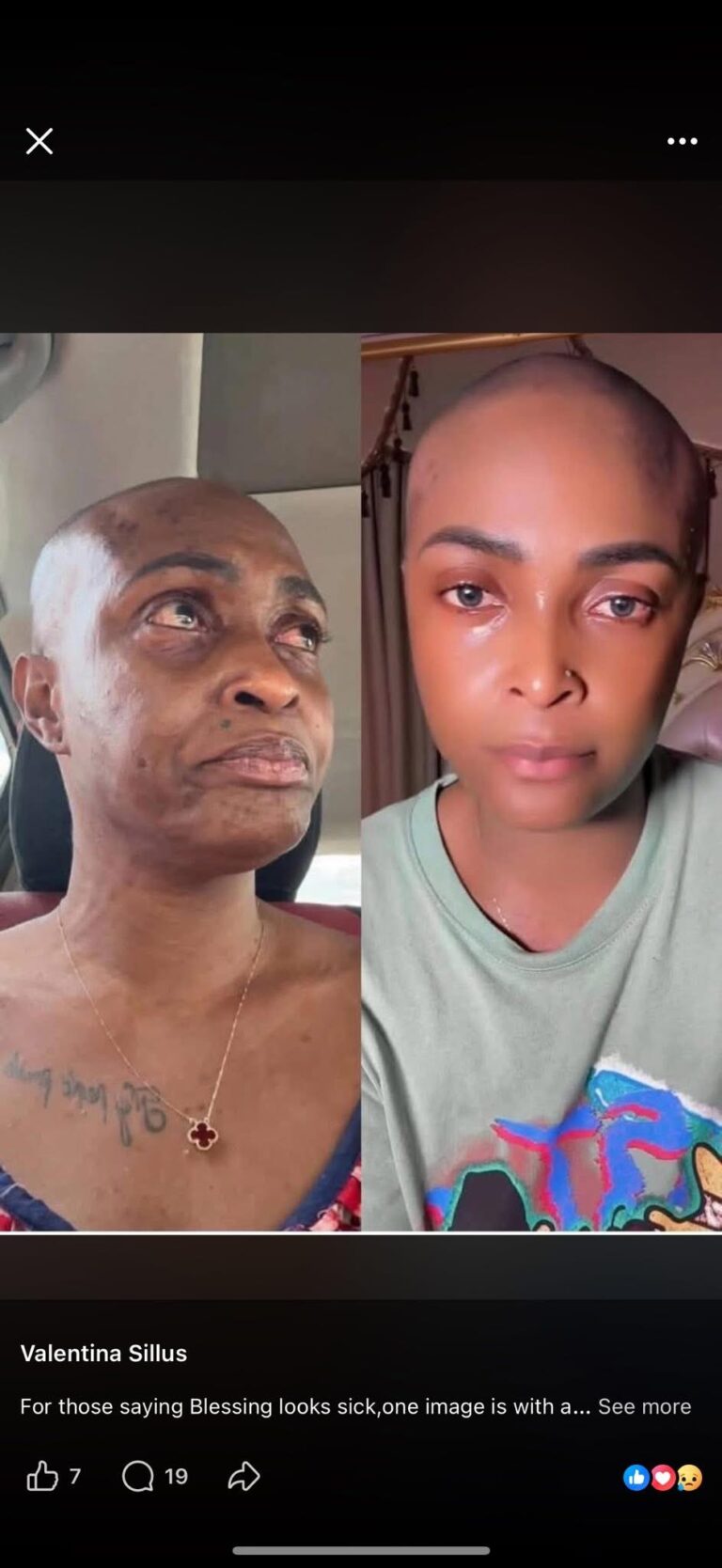 Blessing CEO Faces Backlash After Cancer Claim Controversy